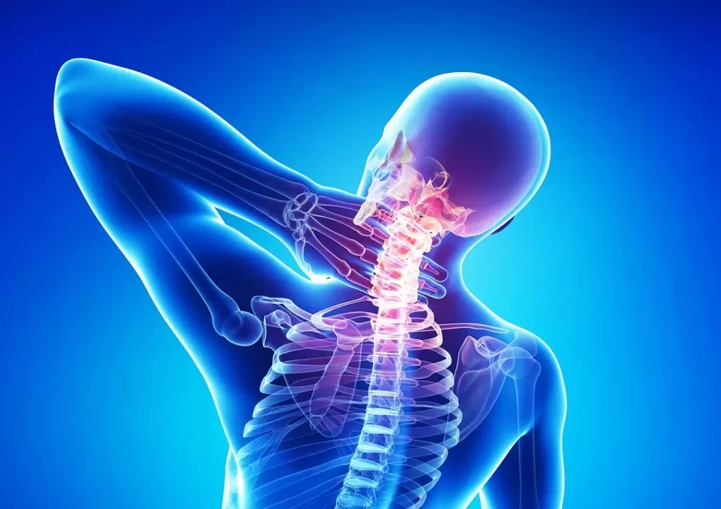 hogyan gyógyítható a nyaki osteochondrosis